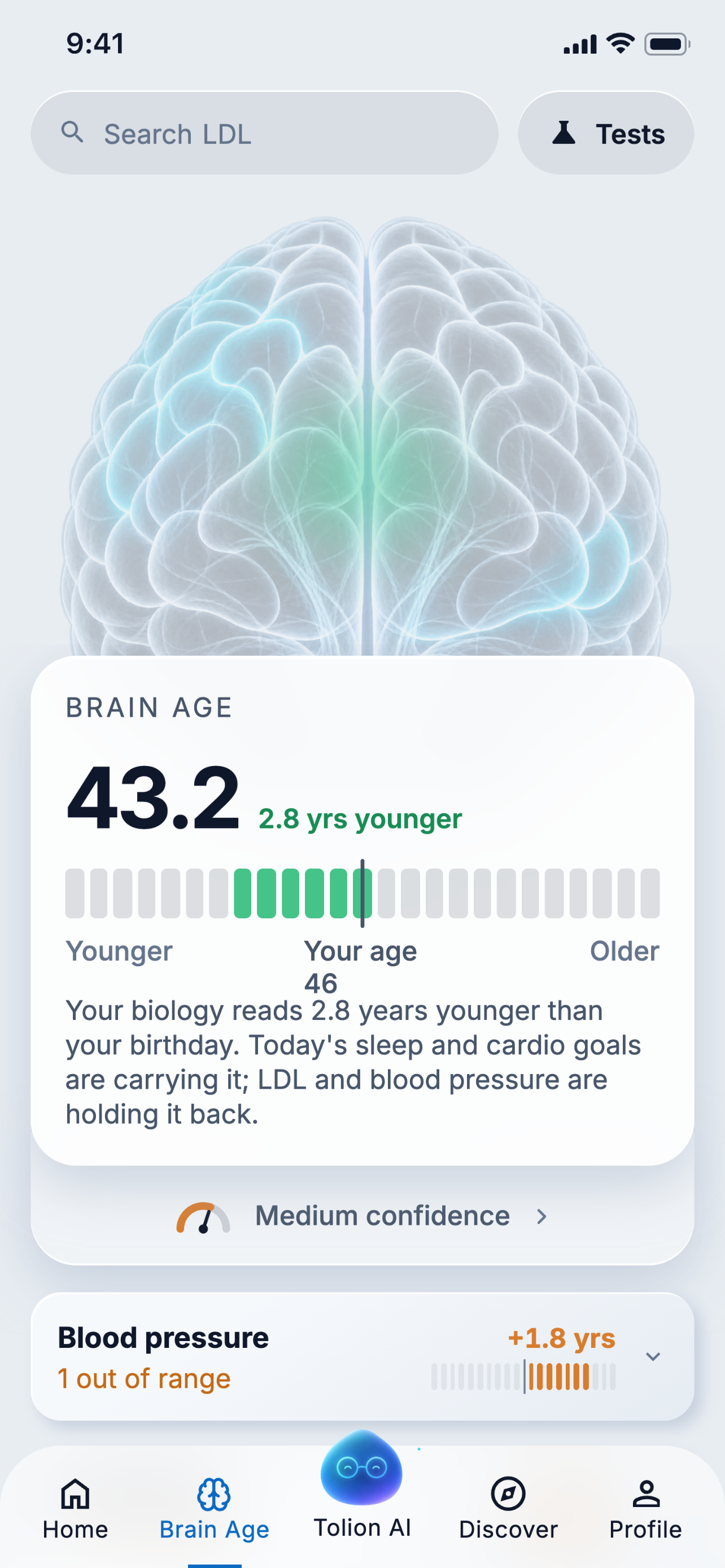 Brain Age